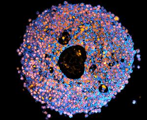 Microscope image of placenta organoid (mini placenta).