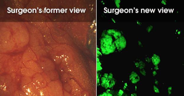 On Target Cancer Imaging Agent