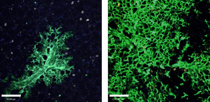 New Lung Cells