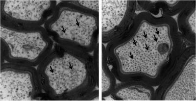 New Class of Alzheimer's Drug