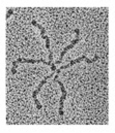 Tenascin-C (TNC)