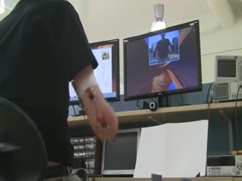 A New Method for the Treatment of Phantom Limb Pain after an Amputation (1 of 3)