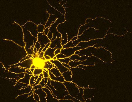 Retinal Ganglion Cell