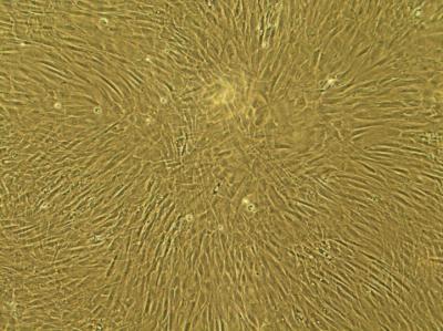 Human Fibroblasts Will Be Grown