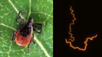 Deer Tick and Lyme Disease Bacteria