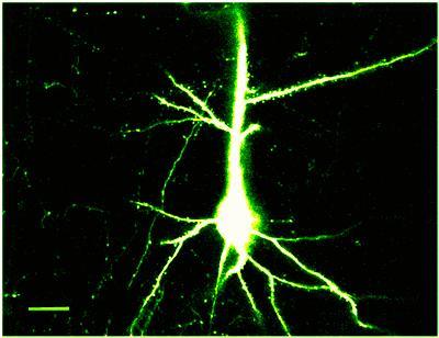 Limiting Stroke Damage is Focus of Study