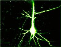 Limiting Stroke Damage is Focus of Study