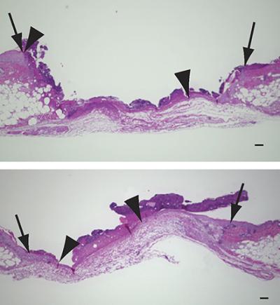 Wound Healing