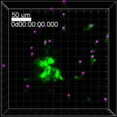 T Cells Attack Pancreatic Islets