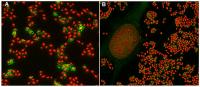Bacterial Expression of <i>Escherichia coli</i>