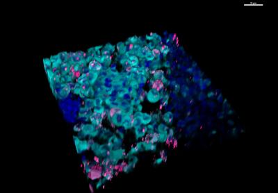 Princeton Researchers Link Phase Separations to Cancer and Discover Organelle