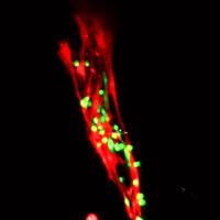 Injured Muscle Strand with Transplanted Stem Cells