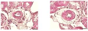 Kidney blood vessels