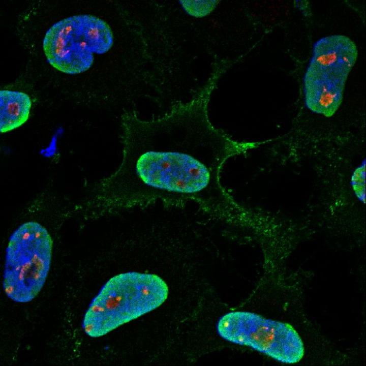 Infection of Human Cells with Hendra Virus