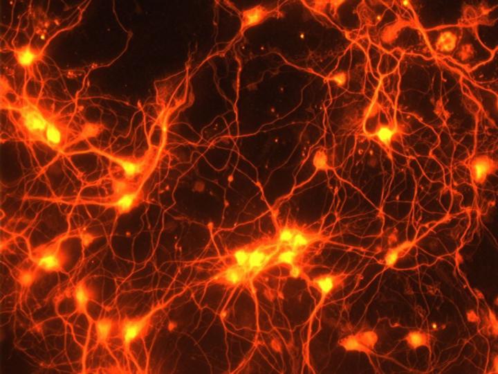 Neurons