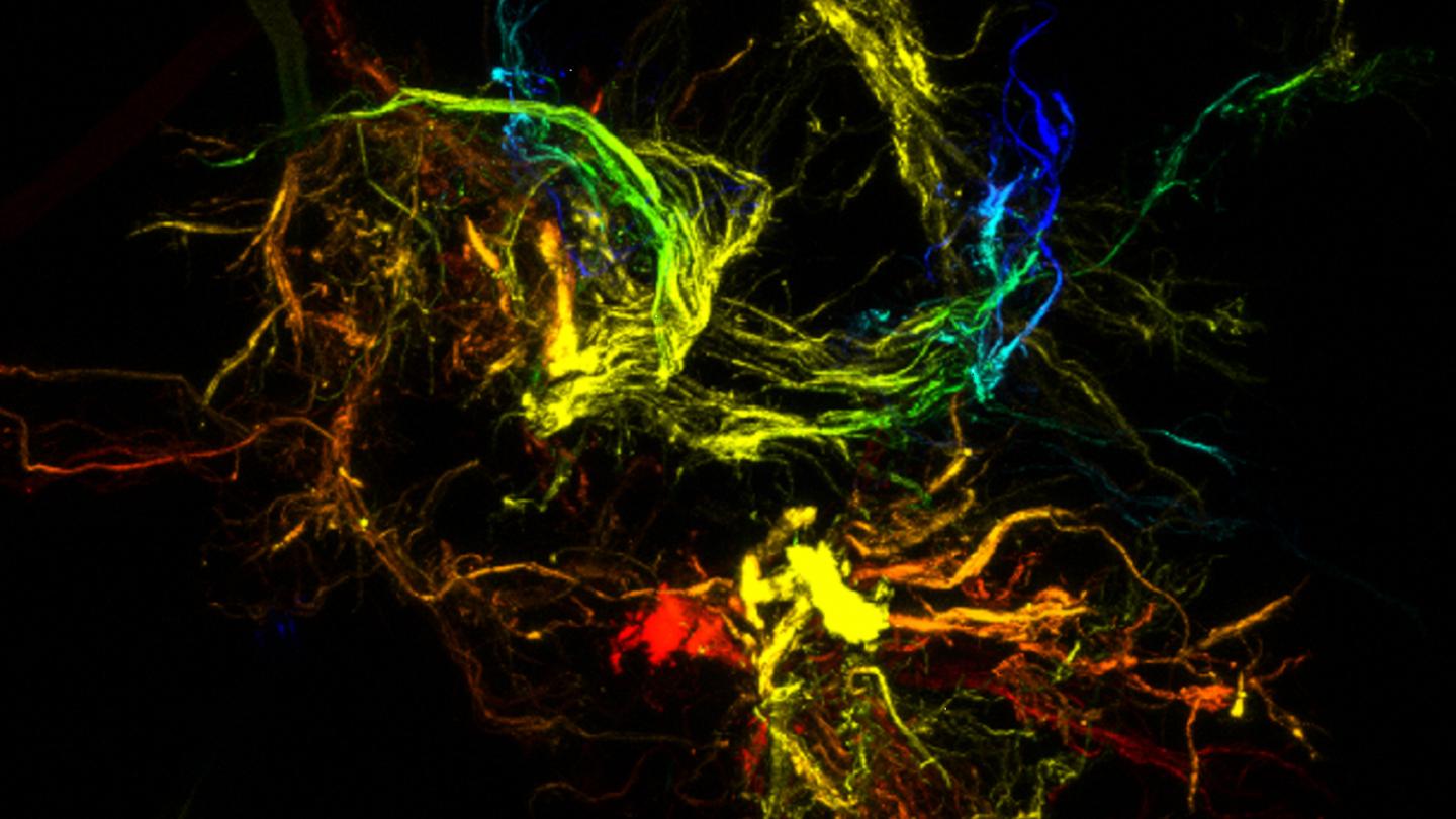 Sticky Branched Particles Formed by Harnessing Liquid Chaos