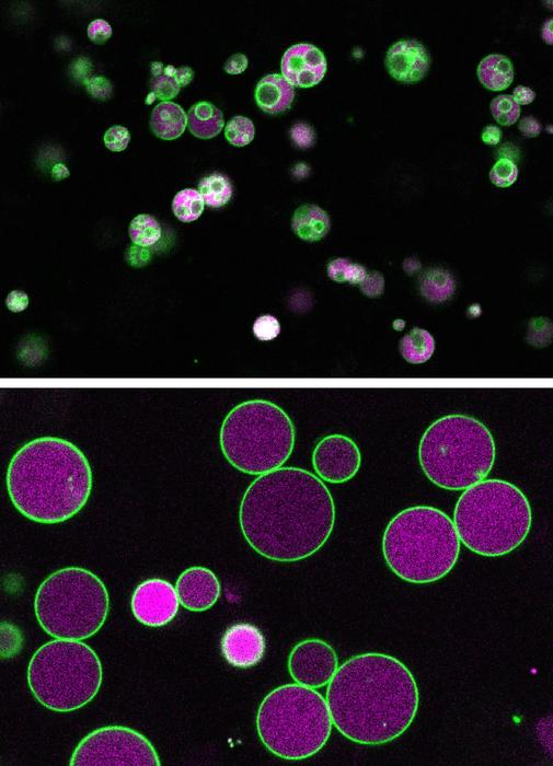 Normal and mutant peroxisomes