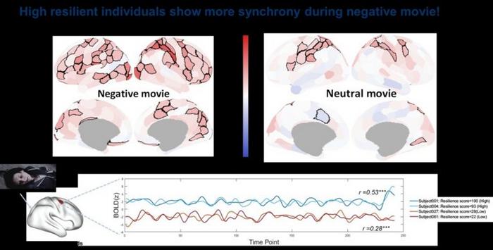 Brain activity