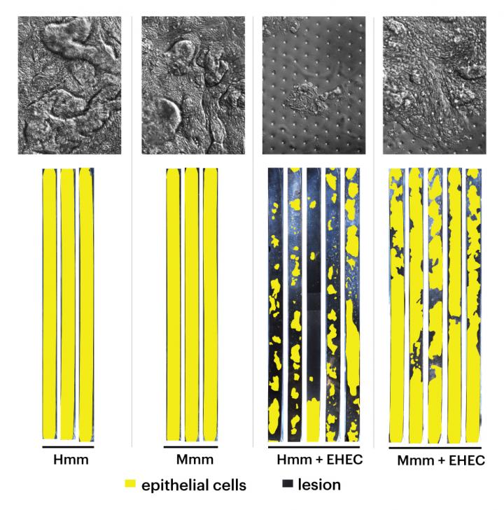 Enterohemorrhagic Ecoli Pathogenesis