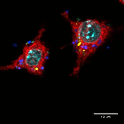 From Friend to Foe: How Benign Bacteria Evolve To Virulent Pathogens