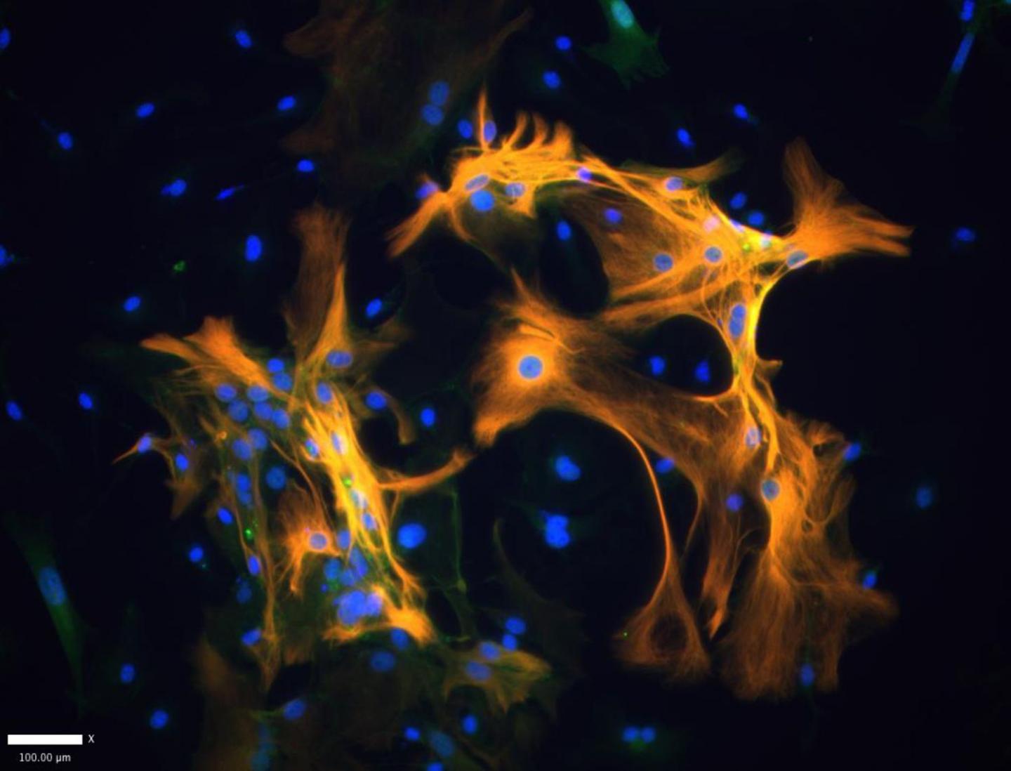 Active HIV in Large White Blood Cells May Drive Cognitive Impairment in Infected Mice