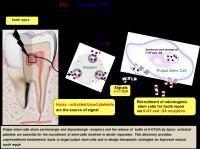 Tooth Repair Mecanisms