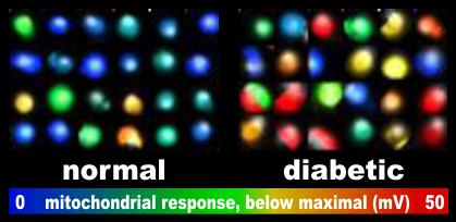 An Imbalance of Cellular Bioenergetics Linked to Type 2 Diabetes