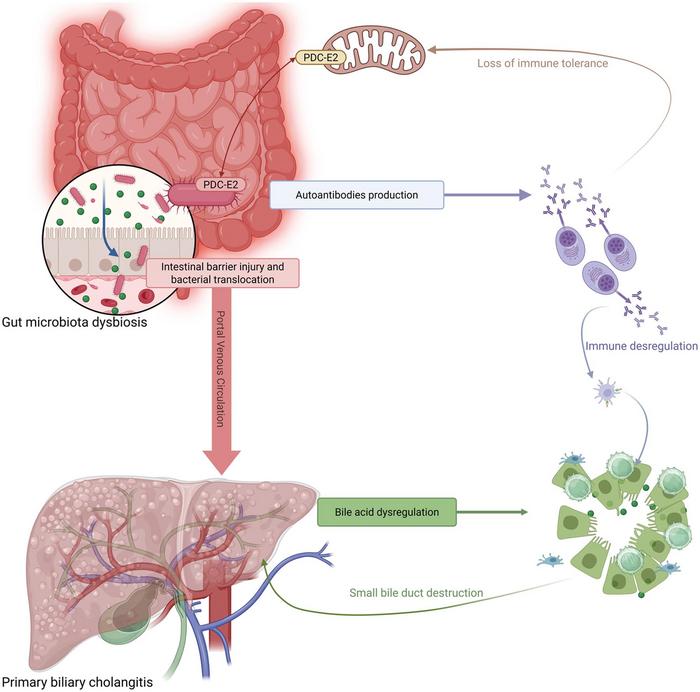 Gut Microbiota: Implications in Pathogenesis and Potential Therapeutic Target in Primary Biliary Cholangitis