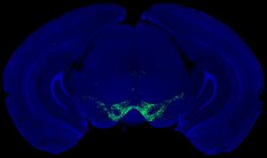 Brain imaging capture
