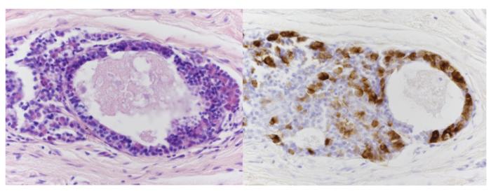 Transplanted pituitary tissue after three months