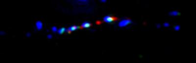 Chromatin Fiber