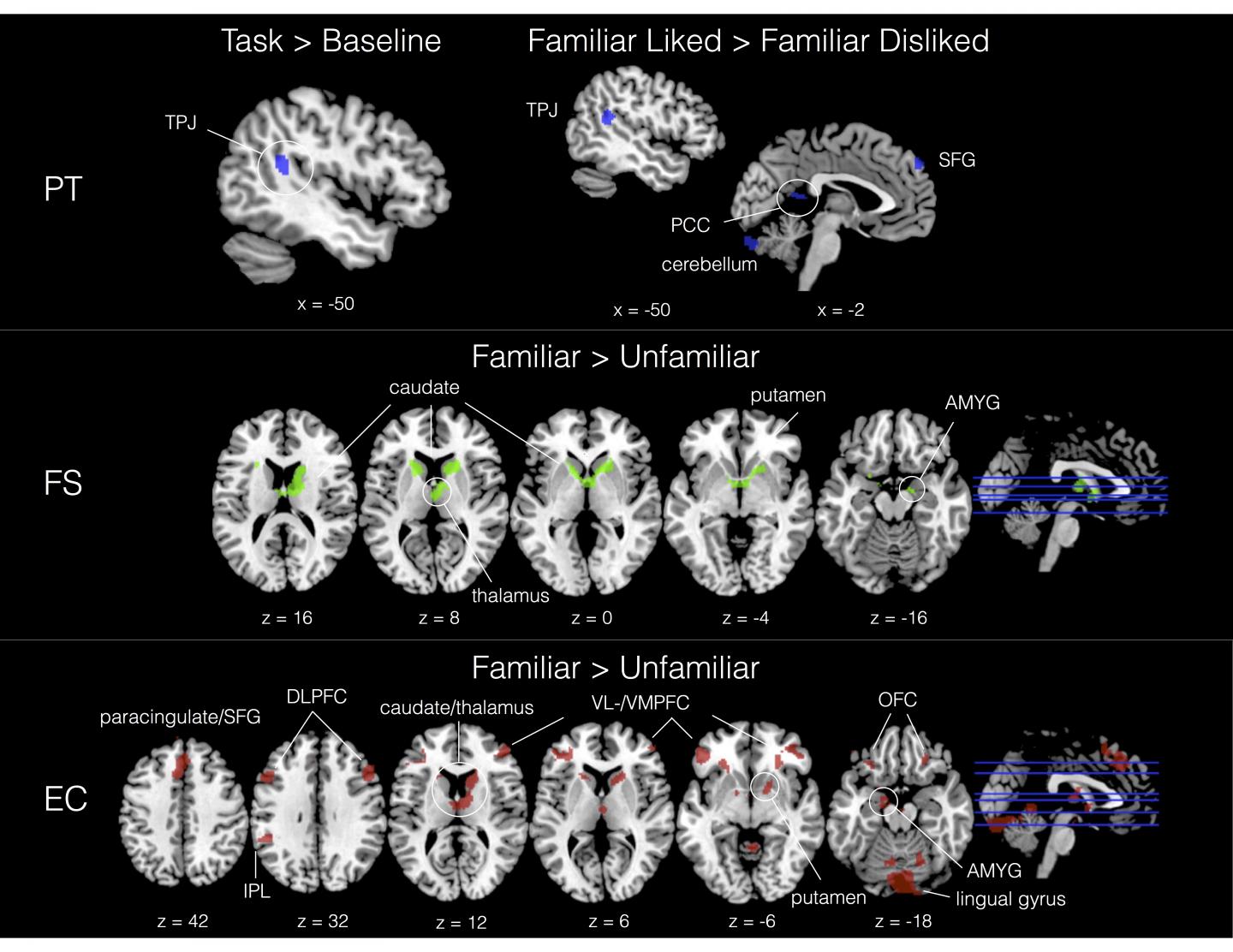 Brains Unique in How they Activate