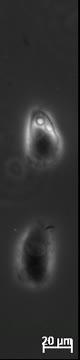 Cancer Cell Sliding Behavior