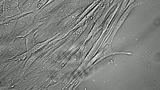 A Skin Cell Becomes a Neuron before Your Eyes