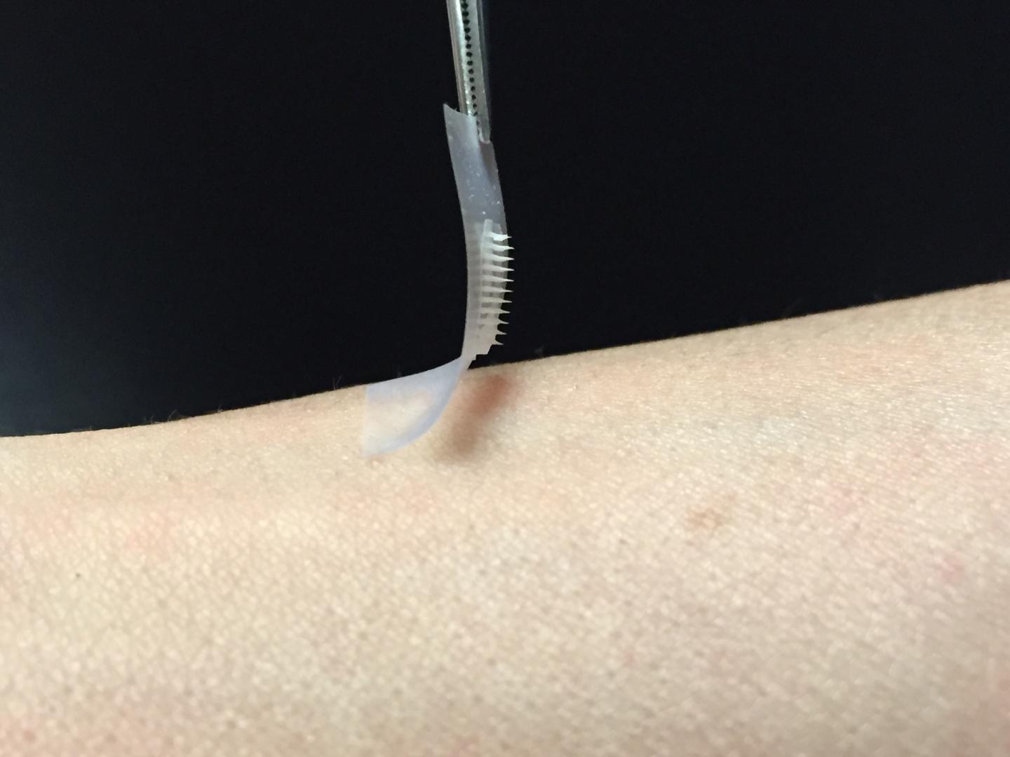 Smart Insulin Patch (1 of 2)