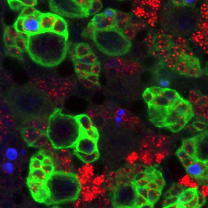 Neural Stem Cells on the <i>Drosophila</i> Brain