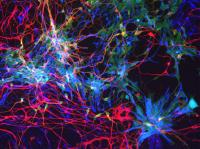Human Cortical Cells