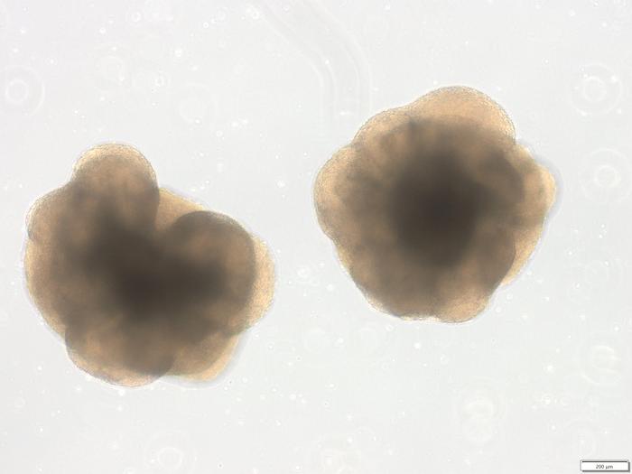 Two brain organoids