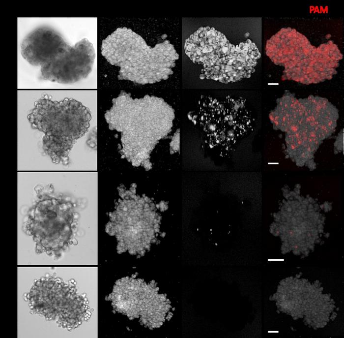 Figure 3. Representative images of cancer spheroid models.