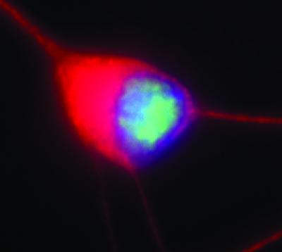 Stressed-out Motor Neuron