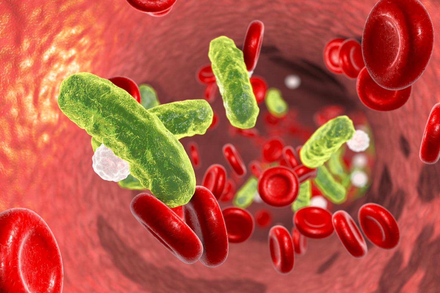 Sepsis Graphic