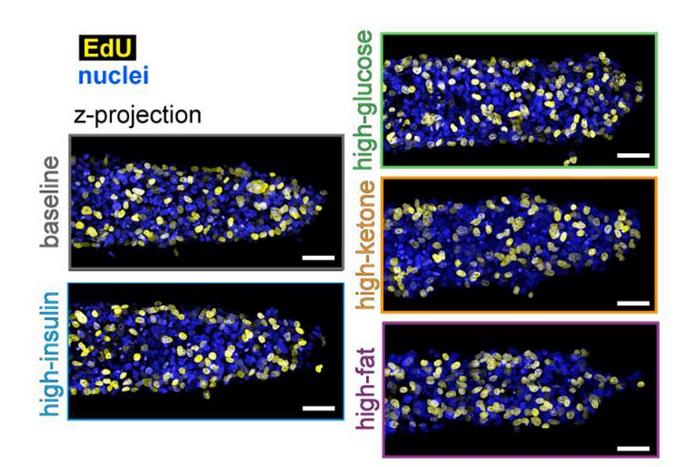 Princeton researchers found that a high-fat diet accelerates growth and invasion of breast cancer tumors