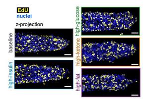 Princeton researchers found that a high-fat diet accelerates growth and invasion of breast cancer tumors
