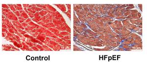 Developing novel therapies to target heart failure