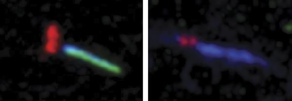 Tmem231 Organizes Meckel Syndrome Complex