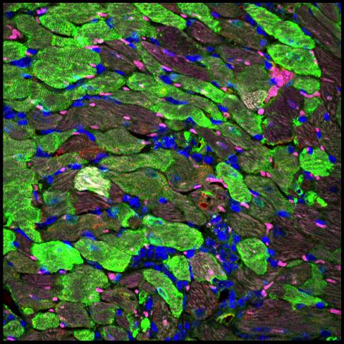 High Magnification Image of the Heart