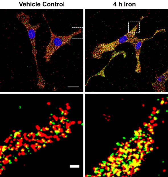 Imaging mRNA Right Where It Is Made -- at the Site of Translation