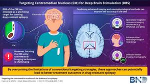 Precision targeting of the centromedian nucleus in epilepsy treatment