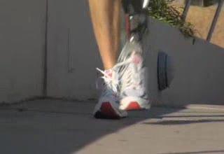 SPARKy Prosthetic Puts Spring Into Step