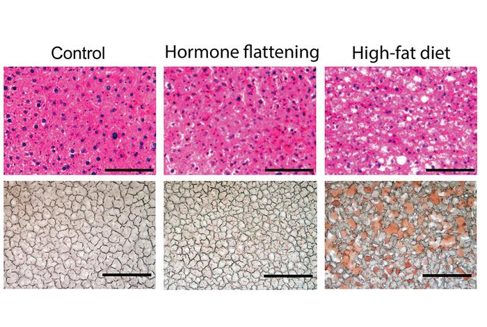 Liver tissue from mice after 60 days of treatment.